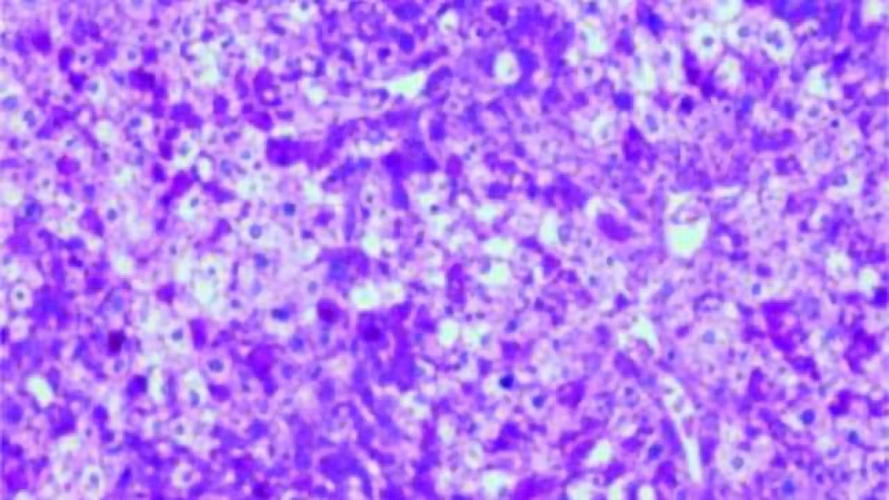 Researchers discover liver and brain communicate in order to regulate appetite