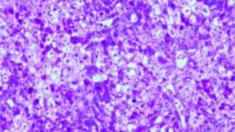 Researchers discover liver and brain communicate in order to regulate appetite