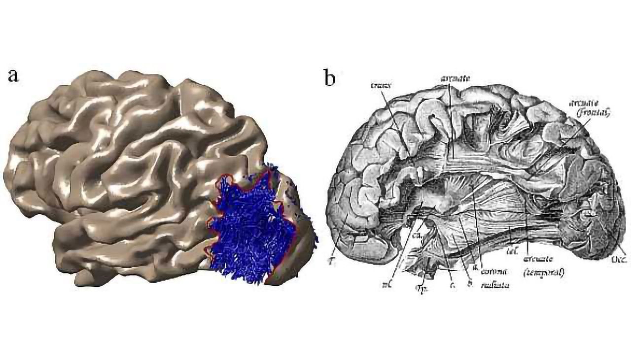 Major brain pathway rediscovered after century-old confusion, controversy