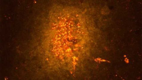 Brain's inflammatory response in overdrive may contribute to common brain disorders