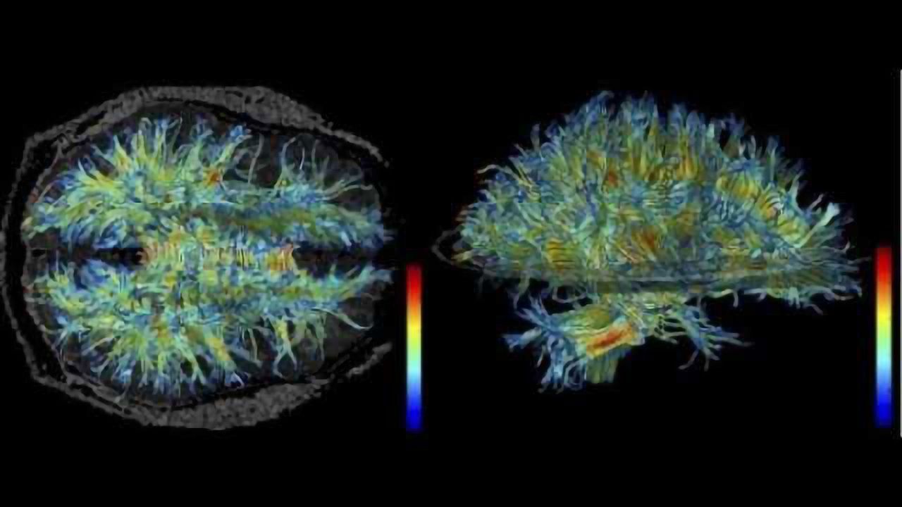 Many older brains have plasticity, but in a different place