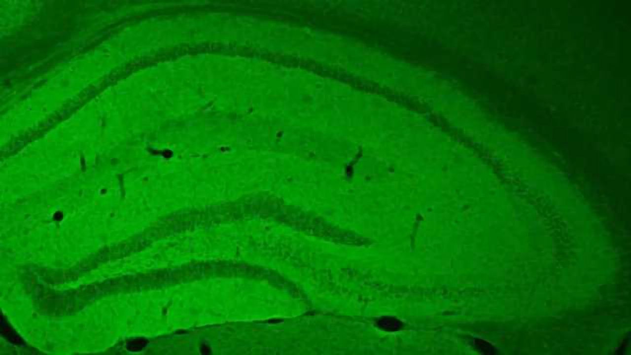 Memory Problems Caused by Sleep Deprivation Prevented