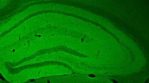 Memory Problems Caused by Sleep Deprivation Prevented