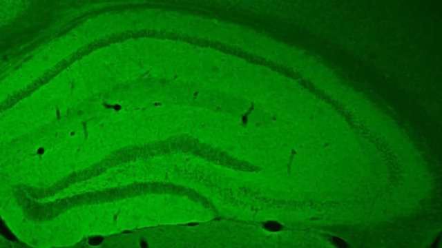 Memory Problems Caused by Sleep Deprivation Prevented | Technology Networks