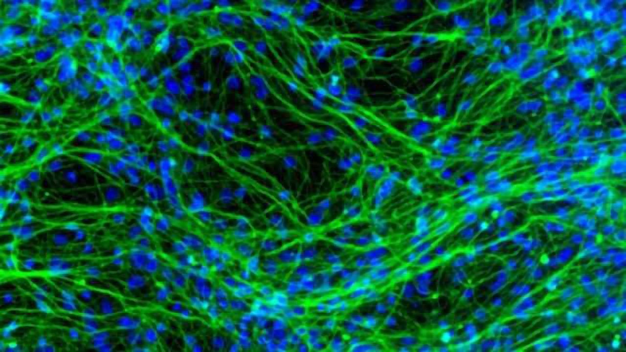 Research presented at Neuroscience 2014 shows potential of stem cells in treating brain diseases