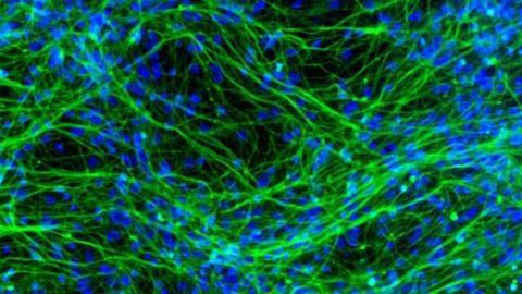 Research presented at Neuroscience 2014 shows potential of stem cells in treating brain diseases