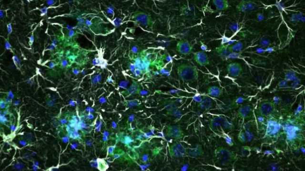 Alzheimer’s disease: Molecular signals cause brain cells to switch into a hectic state