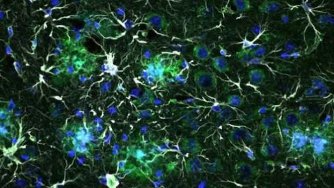 Alzheimer’s disease: Molecular signals cause brain cells to switch into a hectic state