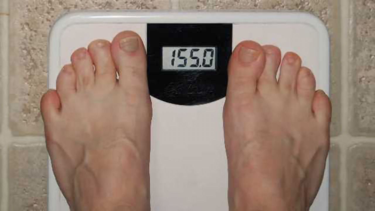 Weight and eating habits in Parkinson's disease