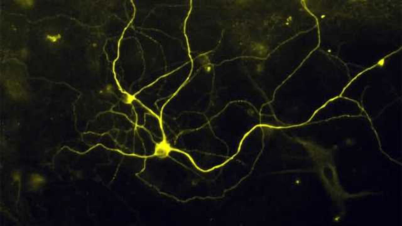 Pain in a dish - Researcher turn skin cells into pain sensing neurons