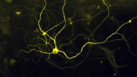Pain in a dish - Researcher turn skin cells into pain sensing neurons