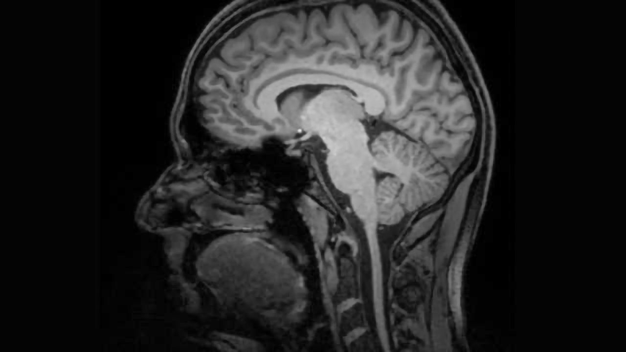Pinpointing the gateway to human memory