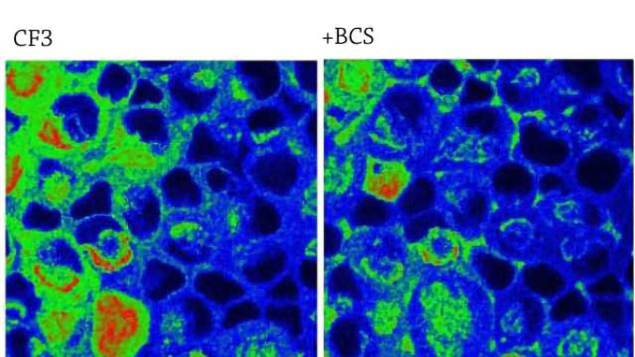 Copper on the Brain at Rest: Lab Reports Proper Copper Levels Essential to Spontaneous Neural Activity