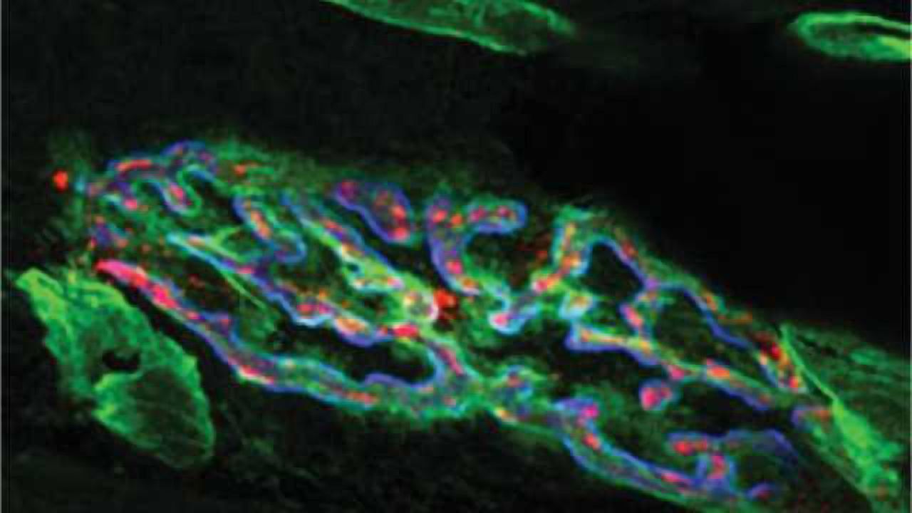 Secret of tetanus toxicity offers new way to treat motor neuron disease