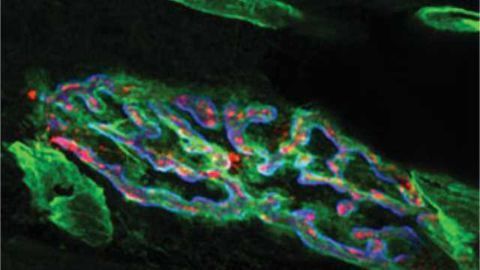 Secret of tetanus toxicity offers new way to treat motor neuron disease