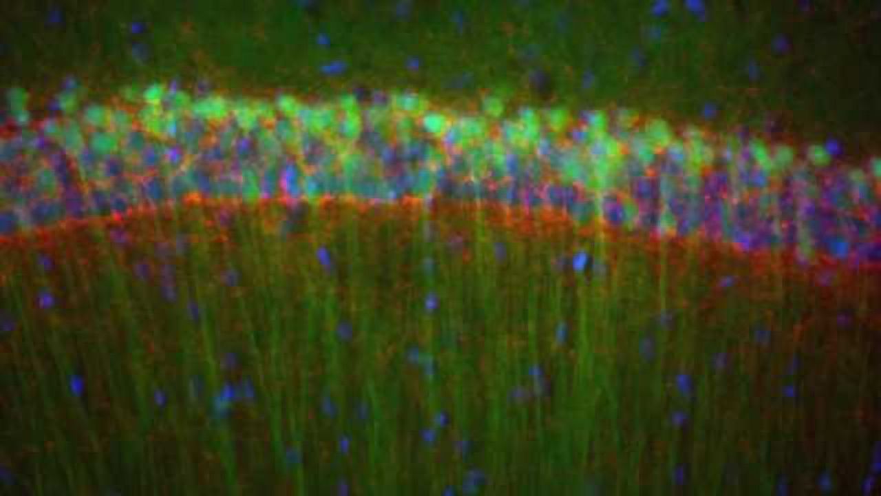 Natural 'high' could avoid chronic marijuana use