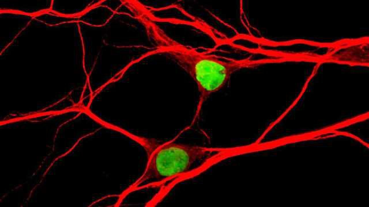 Researchers pinpoint chemo effect on brain cells, potential link to autism