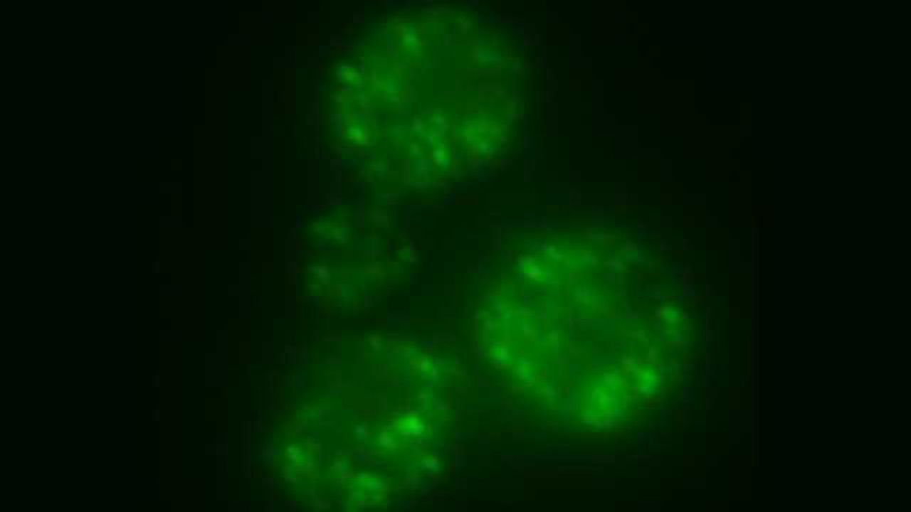 Yeast are first cells known to cure themselves of prions