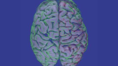 Brain inflammation a hallmark of autism, large-scale analysis shows