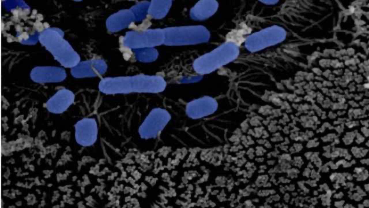 Finnish study establishes connection between gut microbiota and Parkinson's disease
