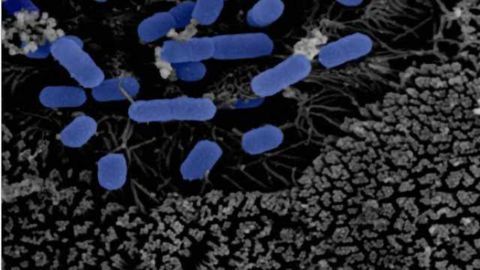 Finnish study establishes connection between gut microbiota and Parkinson's disease