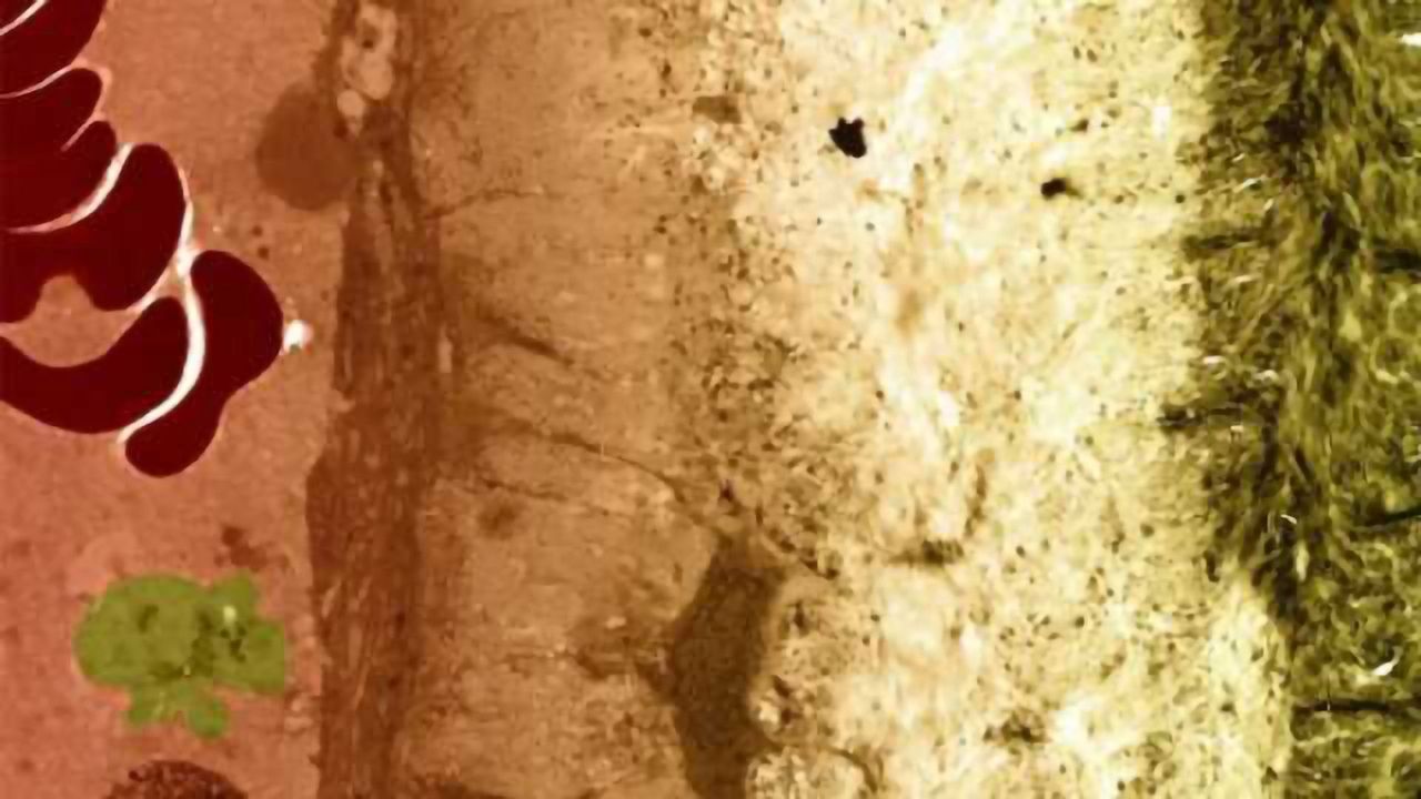 Youngest bone marrow transplant patients at higher risk of cognitive decline