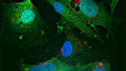 Signaling mechanism could be target for survival, growth of tumor cells in brain cancer