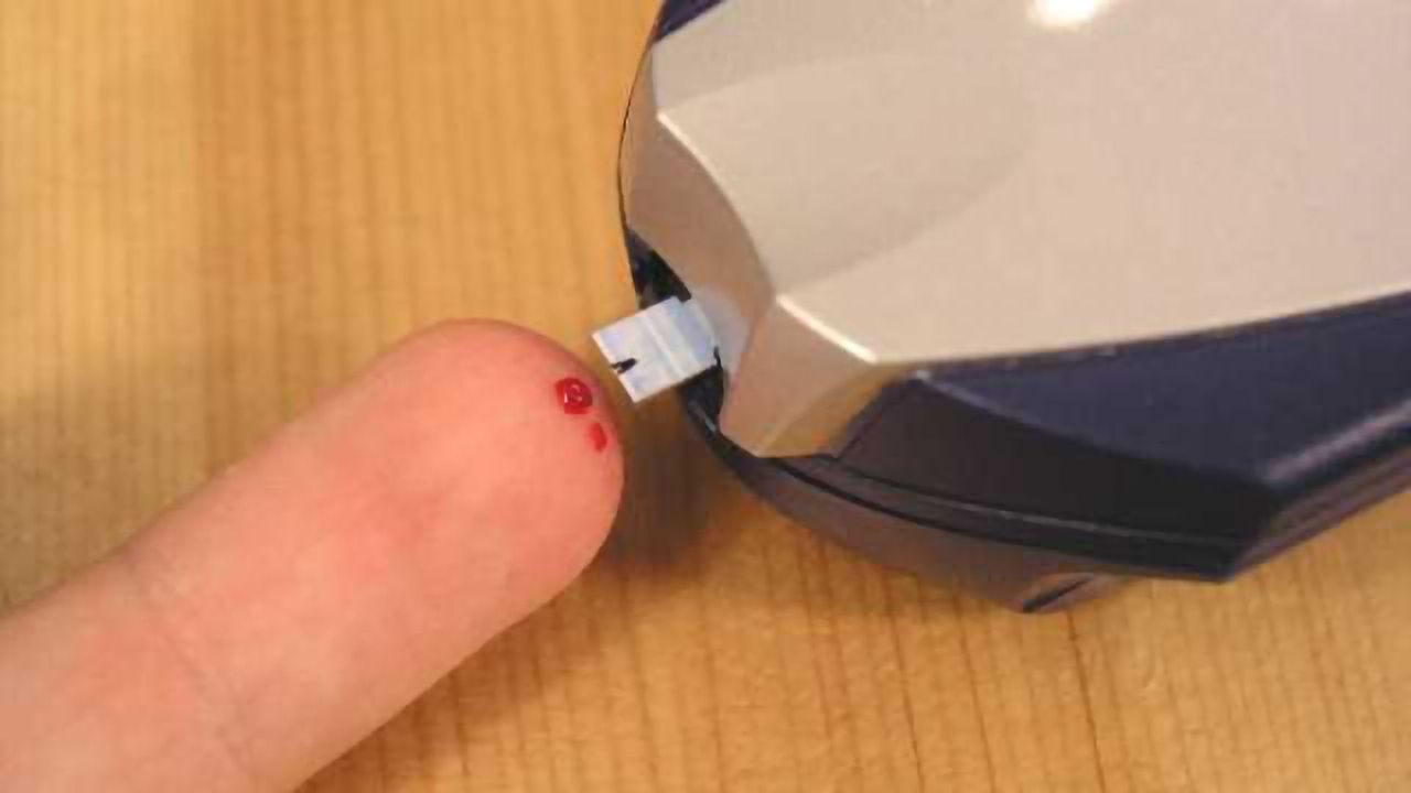 Novel Agent Decreases Neuropathic Pain in Patients with Type 2 Diabetes: New Study