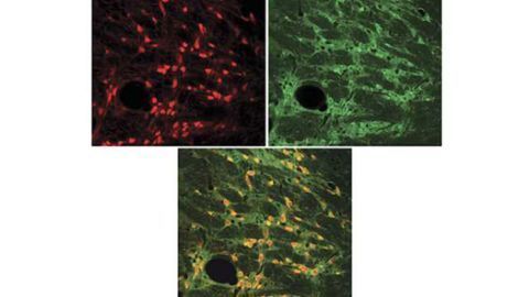 Neuronal circuits filter out distractions in the brain