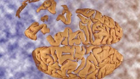 Unpacking brain damage in ALS