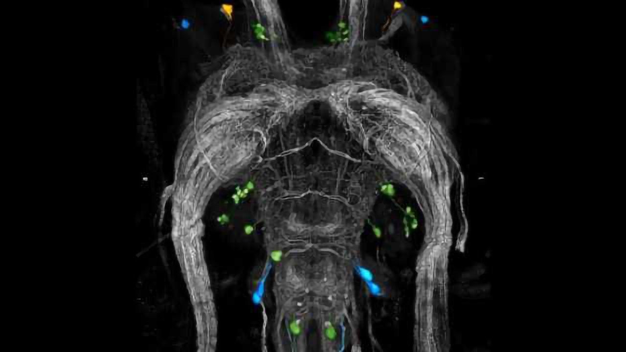 Bugs life: the nerve cells that make locusts ‘gang up’