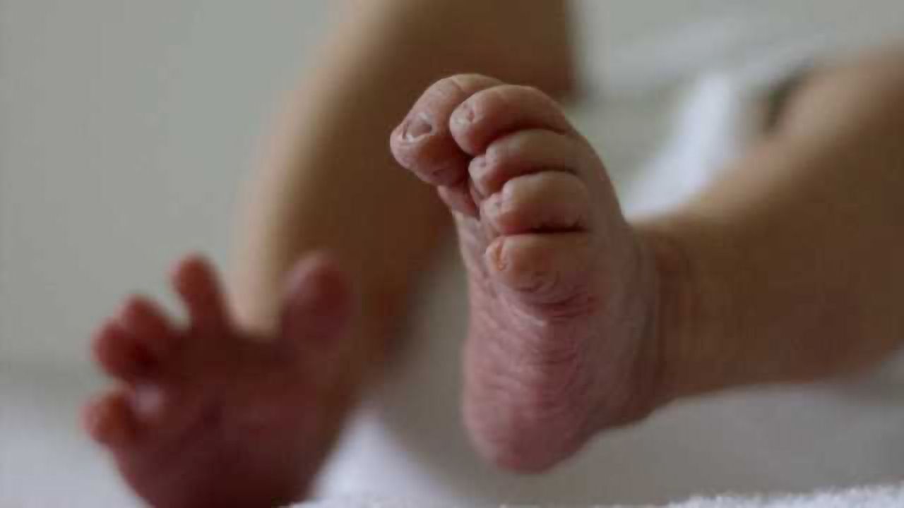 Subtle but important memory function affected by preterm birth