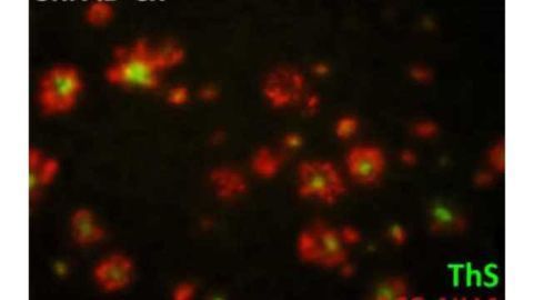 New non-invasive method can detect Alzheimer's disease early