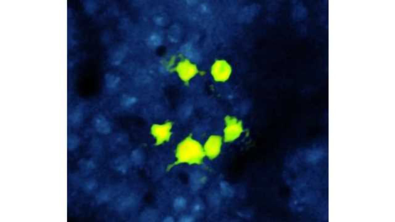 Using light to understand the brain