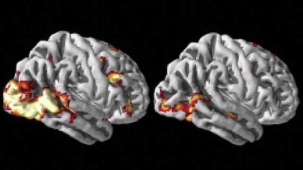 Brain imaging may help predict future behavior