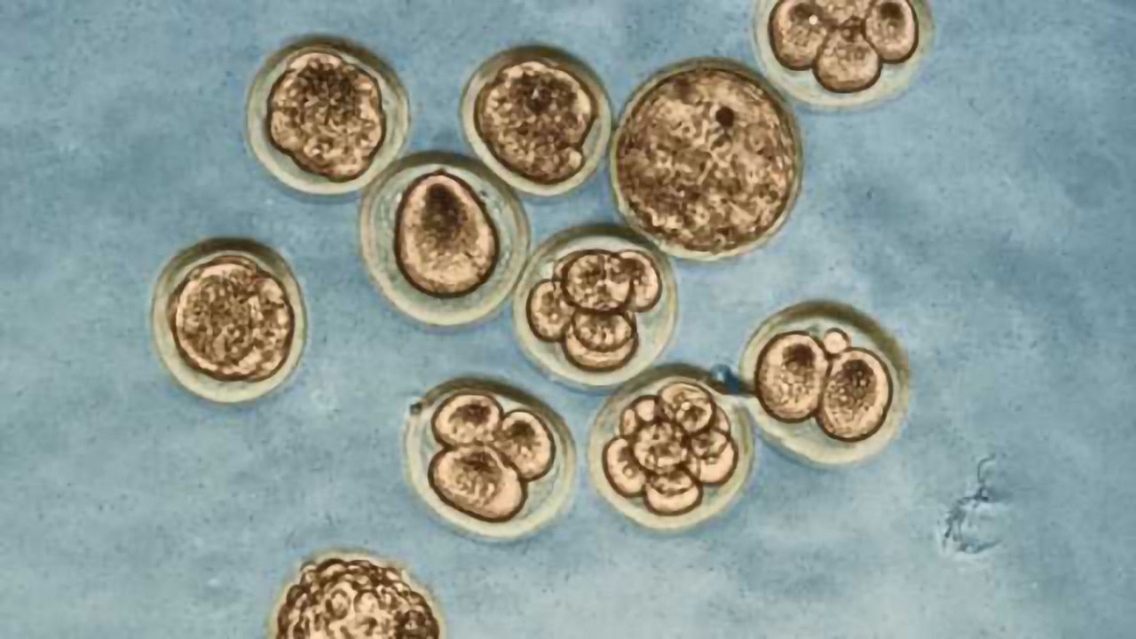 Scientists find drug that helps Huntington's disease-afflicted mice—and their offspring