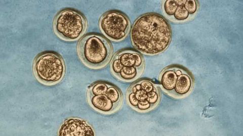 Scientists find drug that helps Huntington's disease-afflicted mice—and their offspring