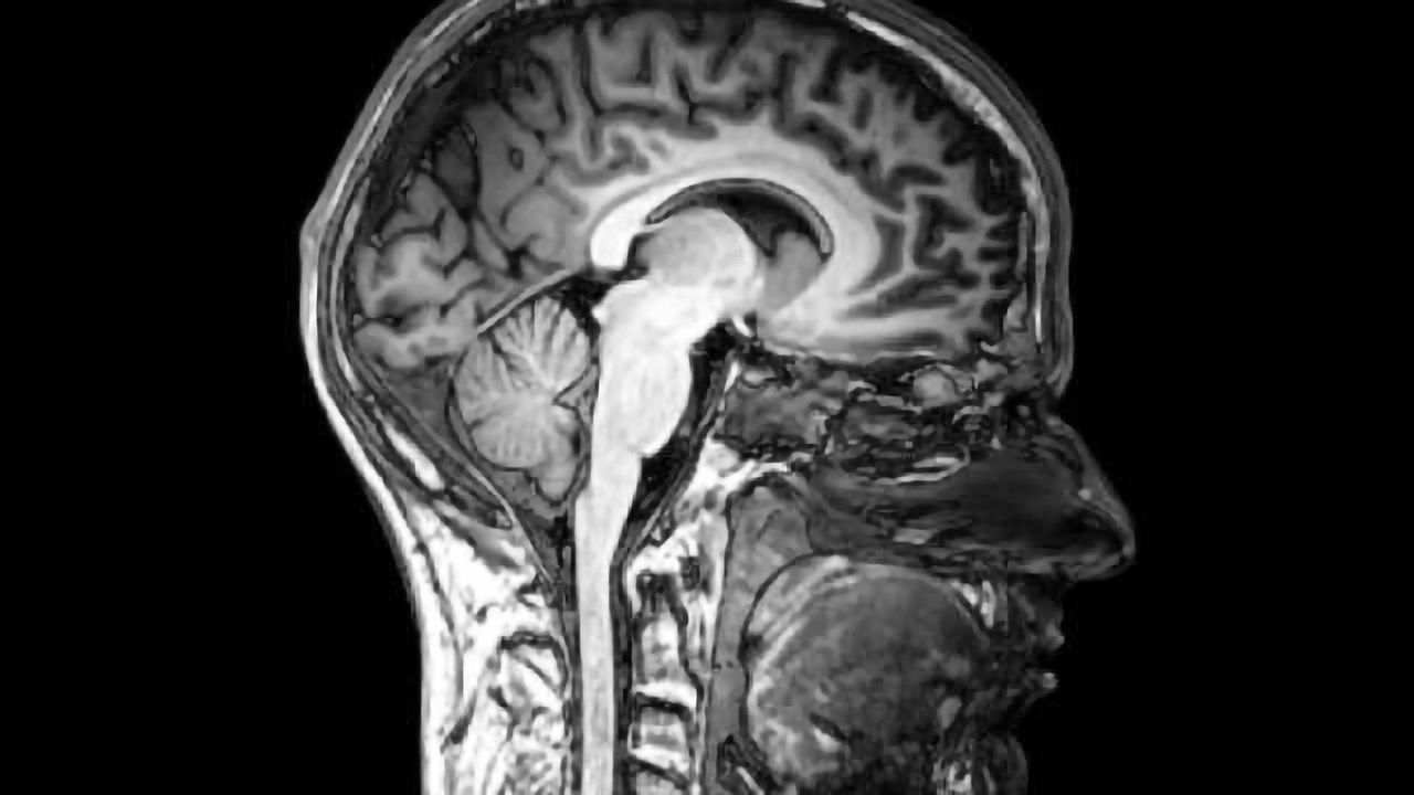 Molecular network identified underlying autism spectrum disorders
