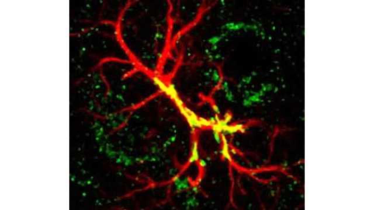 Study Pinpoints Autism-Linked Protein for Sculpting Brain Connections