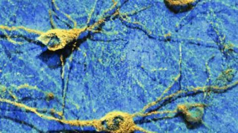 Networks of the brain reflect the individual gender identity