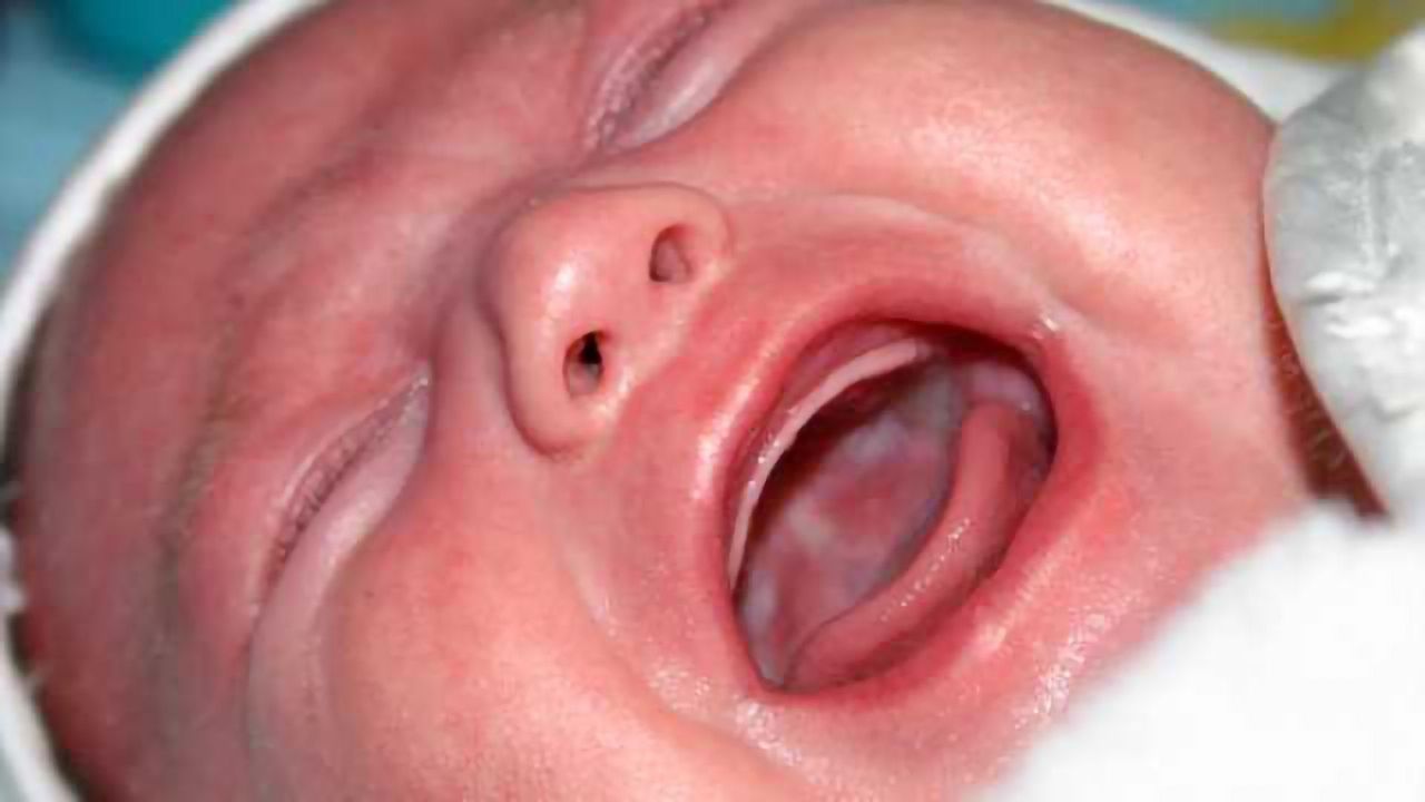 Ritual circumcision linked to increased risk of autism in young boys