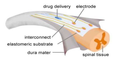 Neuroprosthetics for paralysis: A new implant on the spinal cord