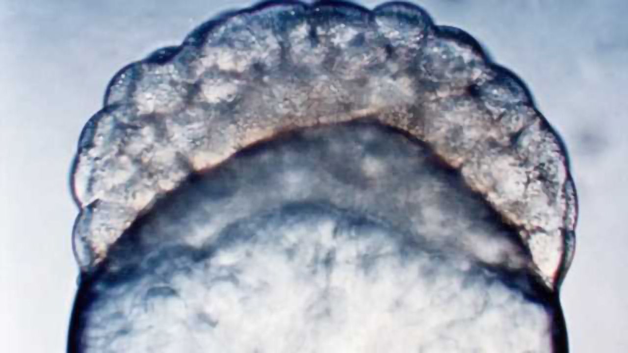 Researchers find BPA and BPS affect embryonic brain development in zebrafish
