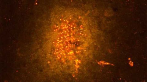 Development of psychosis: Gray matter loss and the inflamed brain