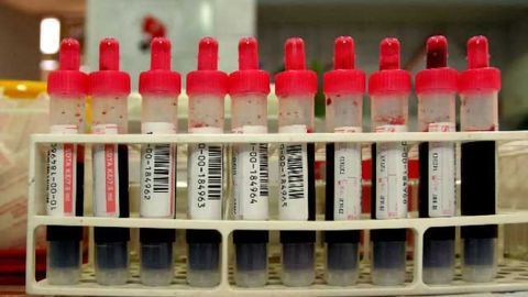 Blood Test for Brain Injury May Not Be Feasible
