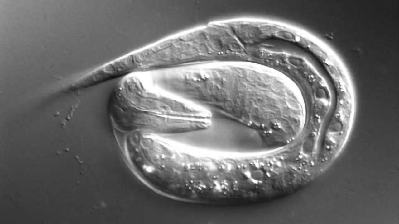 Is there a connection between heavy metals and aging?