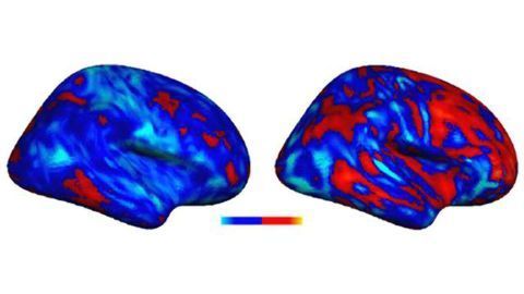 Researchers discover "idiosyncratic" brain patterns in autism
