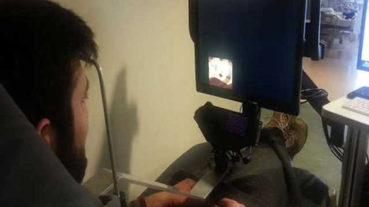 Novel eye-tracking technology detects concussions and head injury severity
