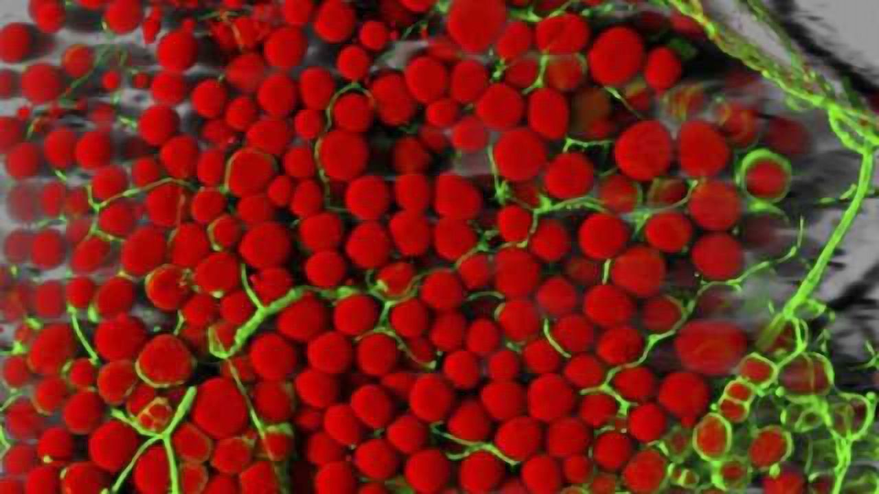 Obesity and diabetes symptoms in mice improved by reversing brain inflammation