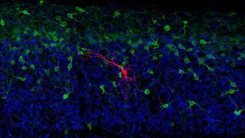 Salk scientists discover how a "mini-brain" in the spinal cord aids in balance